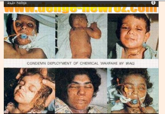 Les enfants de Halabja en Irak, tus au gaz sarin en 1987.